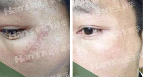 �̺��޸�����