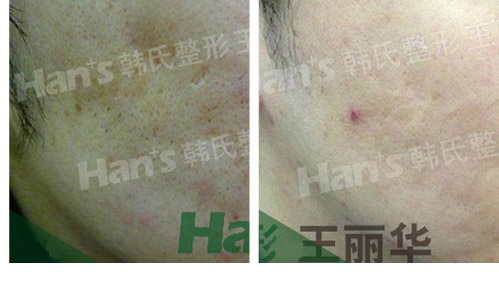 �̺��޸�����