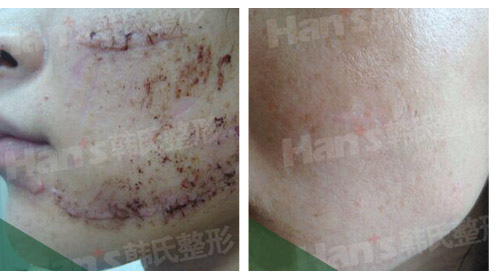 �̺��޸�����