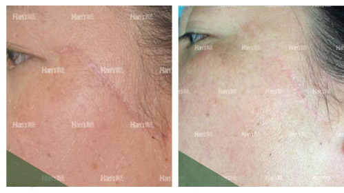 �̺��޸�����