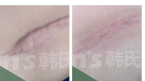 �̺��޸�����