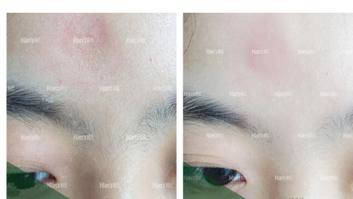 �̺��޸�����