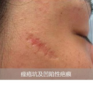 ��Ӽ������԰̺�