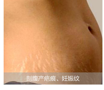 �ʸ����̺ۡ�������