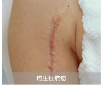 �����԰̺�