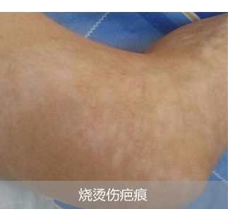 �����˰̺�