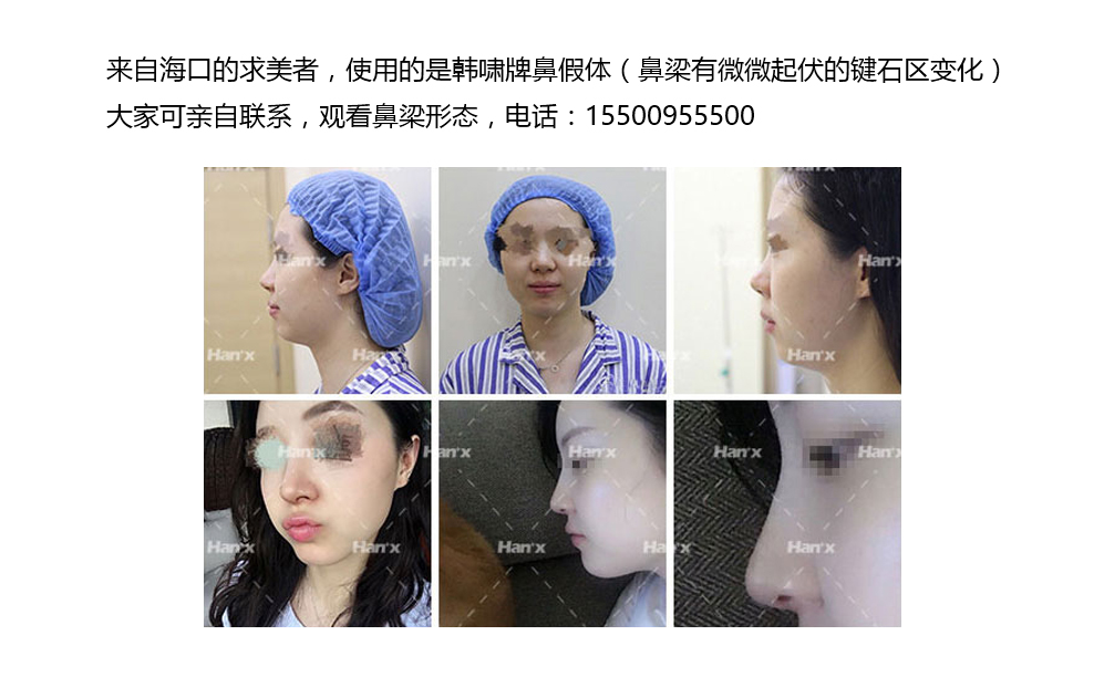 �����ε��˺�Х