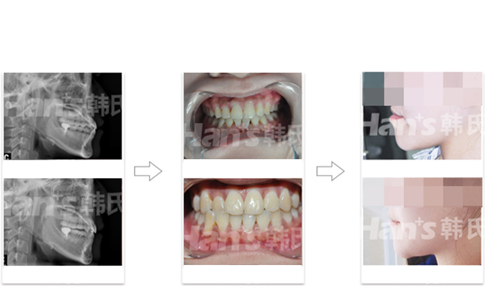 �ذ���������������