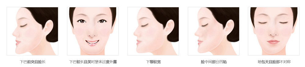 �ذ����������