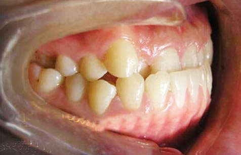 �ذ���/����