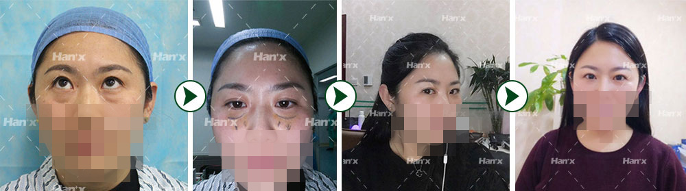 ȥ�۴����˰���