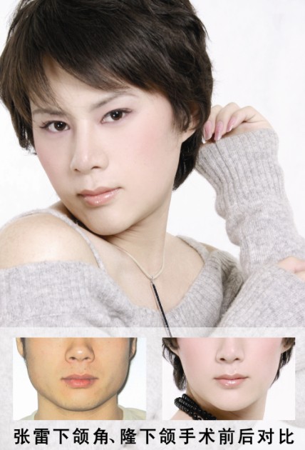 给张雷变性：慈善之精神救赎(图3)