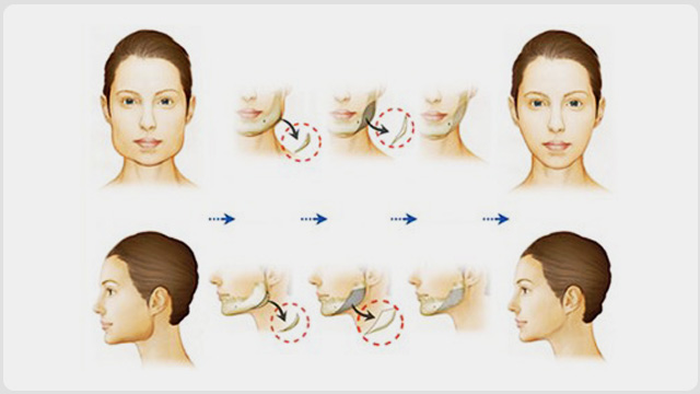 �����޸�