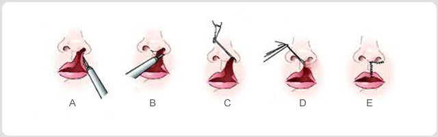 �����޸���