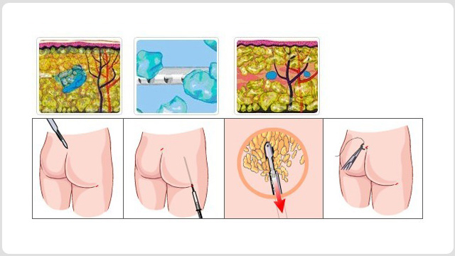 ��Хר���β��ഺ��