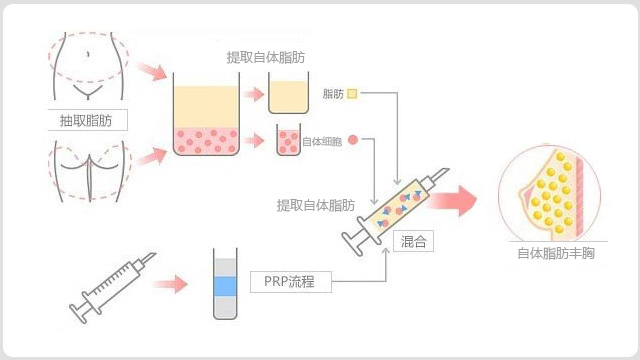 ��Х��������֬������