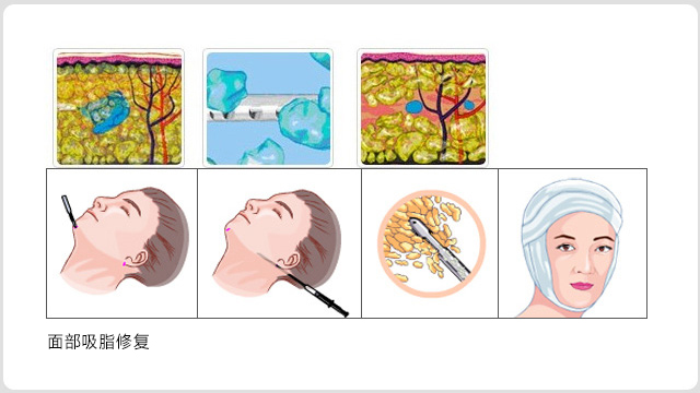 ��Х̸��֬�޸�