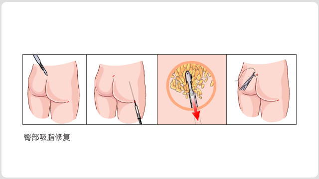 ��Х̸��֬�޸�