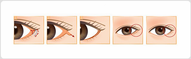 ���۽��޸�