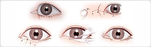 ���۽��޸�