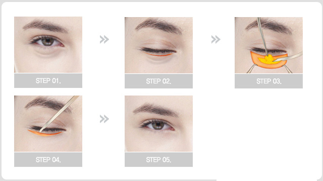 �۴����޸�