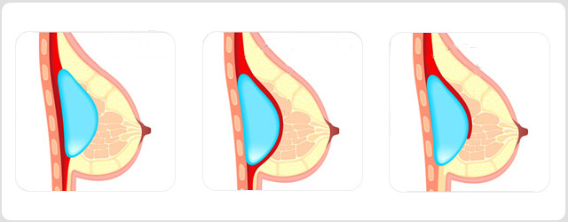 ��Х���μ������