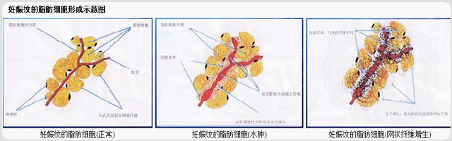 ǩԼ�����ս�������