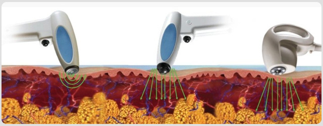 ������Ƶ������֬