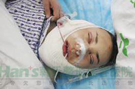 想不到隆鼻后，我的鼻子变得如此高挺秀气(图4)