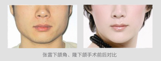 张雷的美丽蜕变(图4)