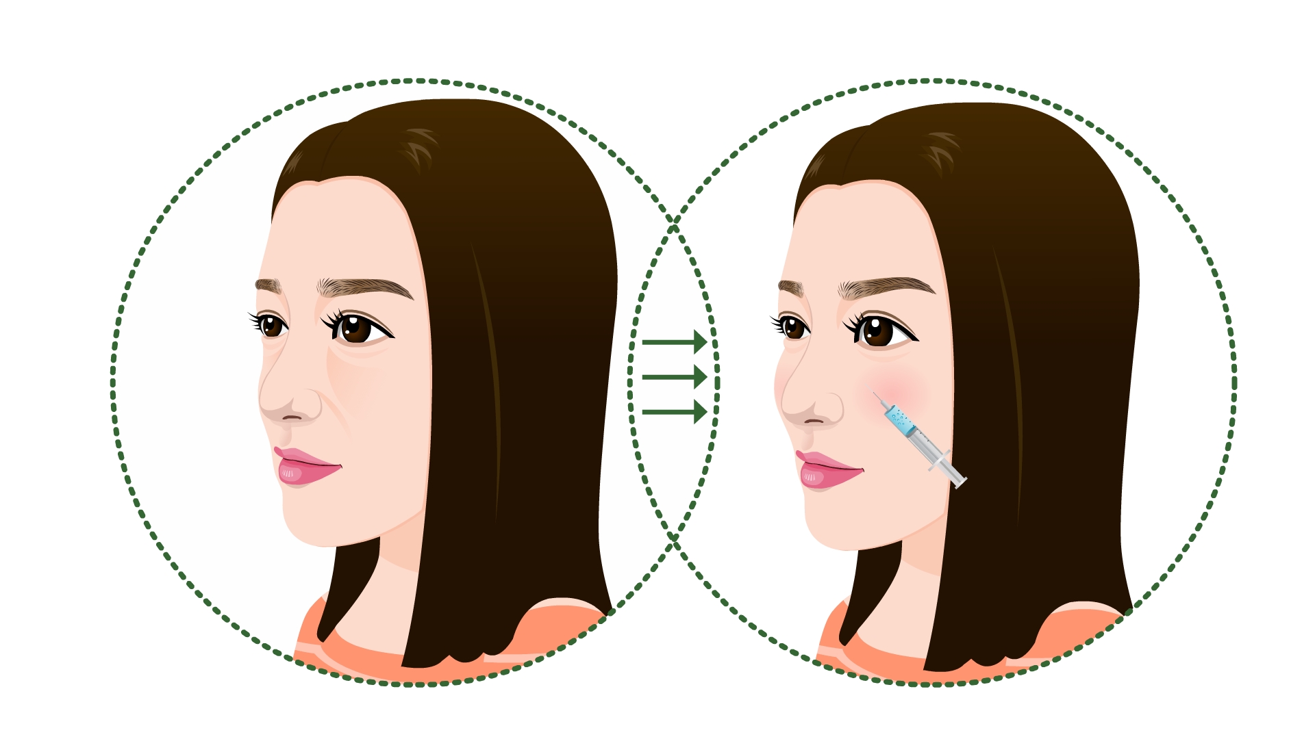 ������Х